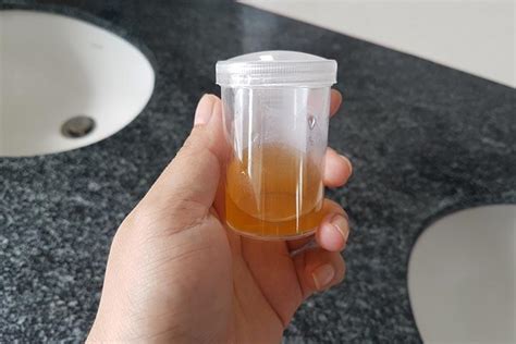 bleach pregnancy test precautions|Bleach Pregnancy Test: Procedure, Accuracy and Precautions.